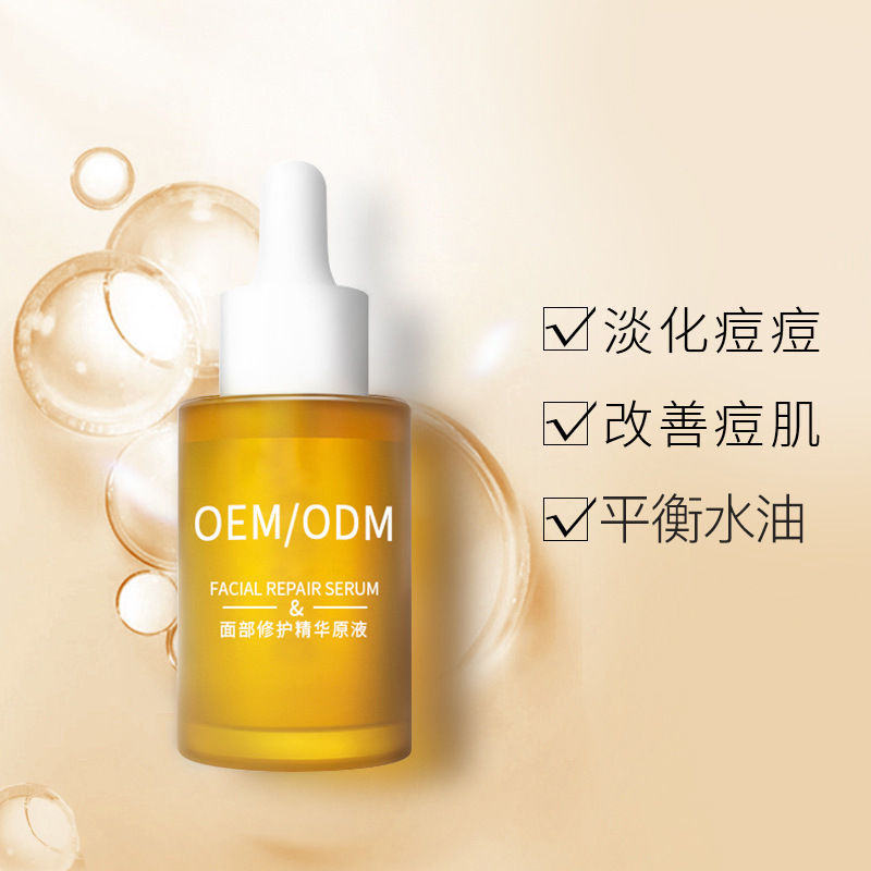 银川市_祛痘精华原液OEM